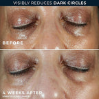 RoC Multi Correxion 5 in 1 Anti-Aging Eye Cream for Puffiness, Under Eye Bags & Dark Circles, Skin Care Treatment with Shea Butter, (.5 oz) with Night Cream Packette (Packaging May Vary)