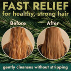 Rosemary Shampoo and Conditioner Set Infused with Tea Tree & Rosemary Oils for Scalp Relief and Hair Growth | Sulfate Free, Soothes Dry Scalp, Boosts Shine + Free Scalp Brush | 16.9 fl oz