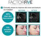 Age Defying Cream with Stem Cell Growth Factors for Anti-Wrinkle, Collagen Boost, and Acne Scarring Repair, Large Size, 1fl oz/30ml