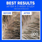 Head & Shoulders Classic Clean Dandruff Shampoo Twin Pack, Anti-Dandruff Daily Use, Paraben-Free, Color-Safe, 32.1 Fl Oz Each (Set of 2)