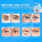 Under eye patches for dark