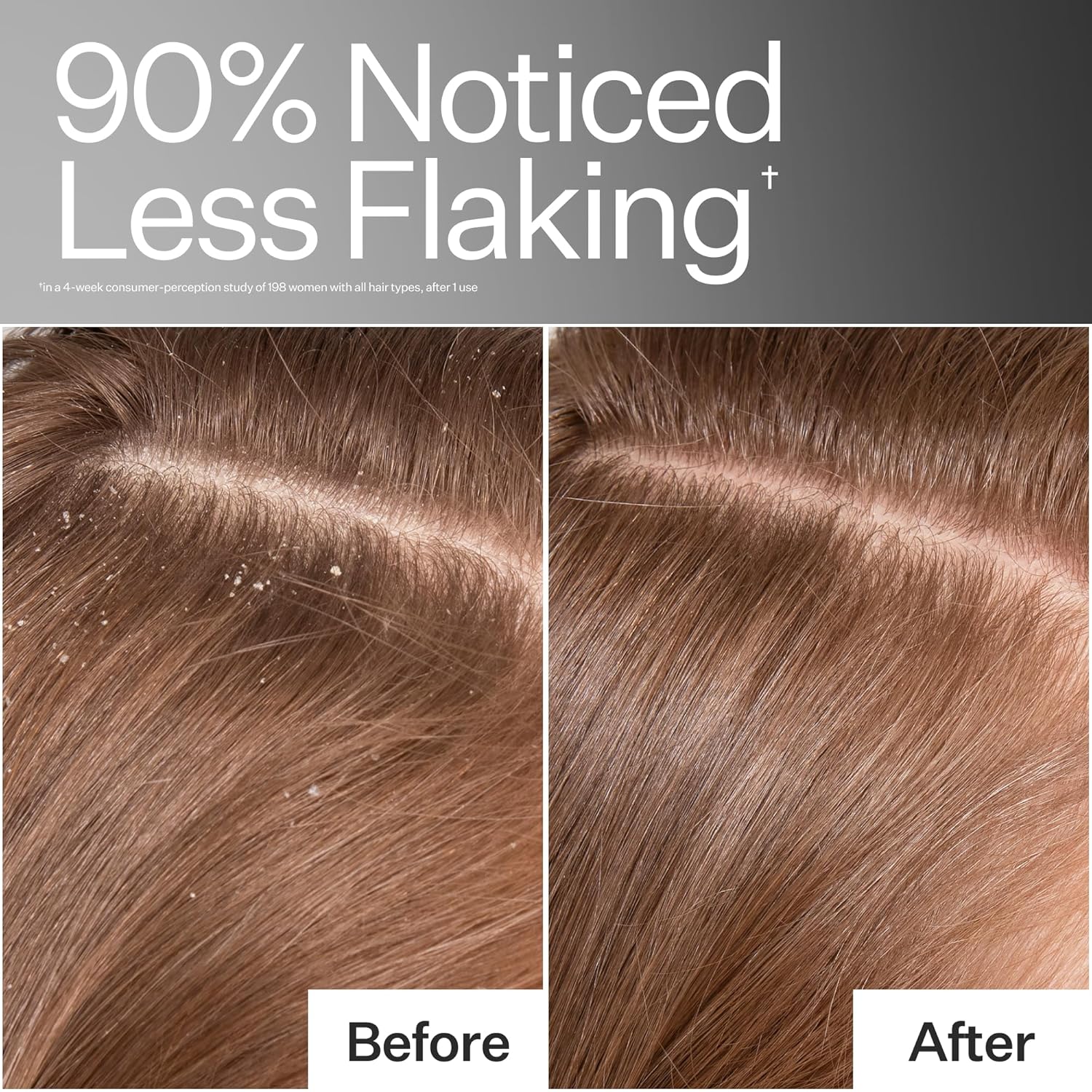 ACT+ ACRE Cold Processed Scalp Detox Oil - Sulfate-Free Care for Flaky, Dry and Itchy Scalp - Promotes Thicker, Fuller-Looking Hair